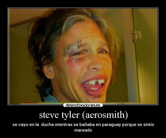 steve tyler (aerosmith) - se cayo en la ducha mientras se bañaba en paraguay porque se sintio mareado