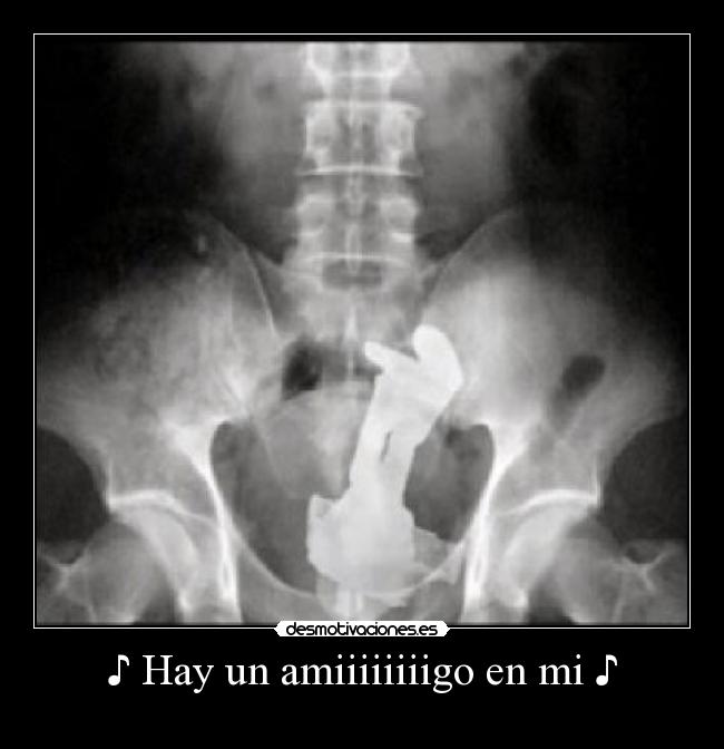 ♪ Hay un amiiiiiiiigo en mi ♪ - 