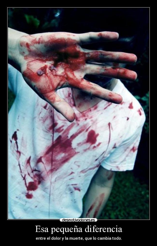 Esa pequeña diferencia - entre el dolor y la muerte, que lo cambia todo.
