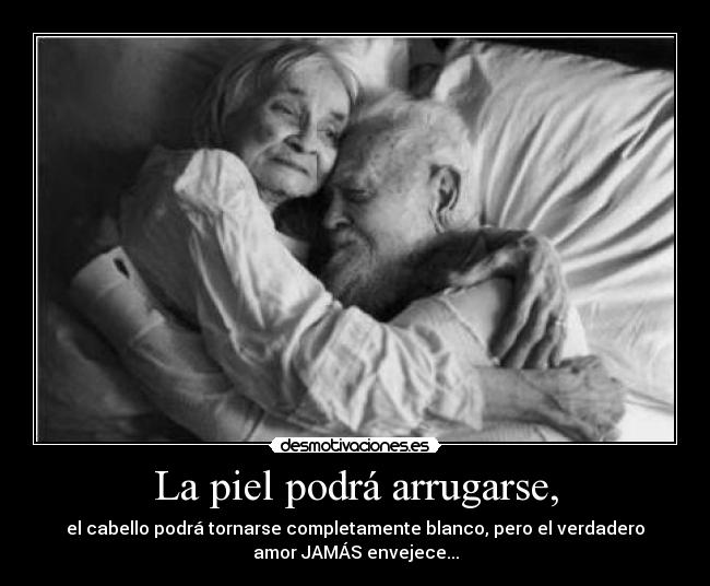 La piel podrá arrugarse, - 