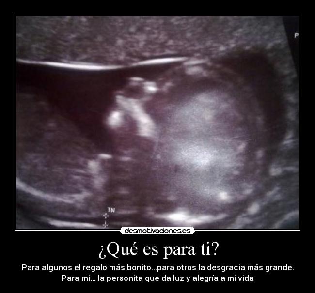 ¿Qué es para ti? - 