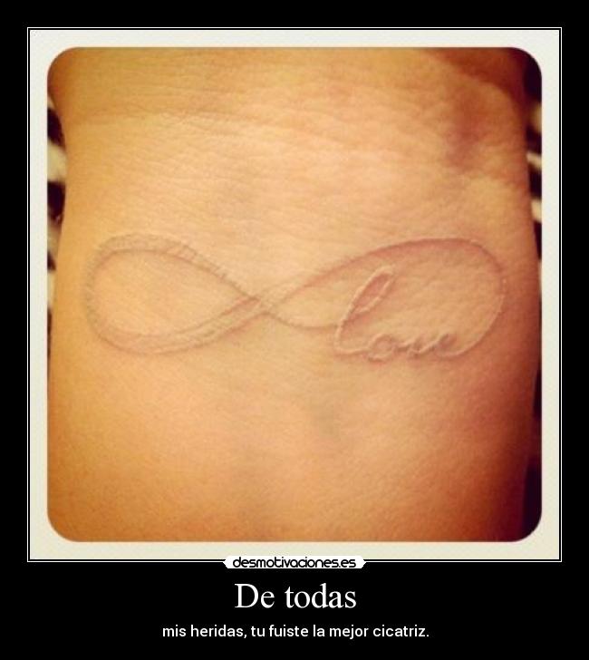 De todas - mis heridas, tu fuiste la mejor cicatriz.