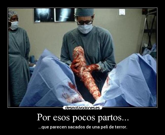 Por esos pocos partos... - ...que parecen sacados de una peli de terror.