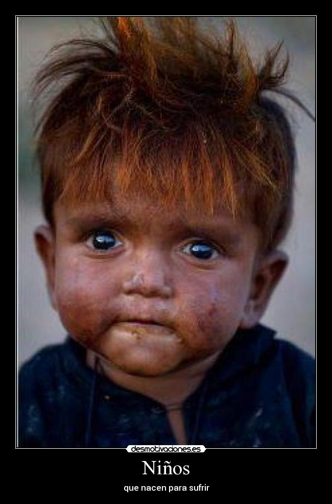 Niños - que nacen para sufrir
