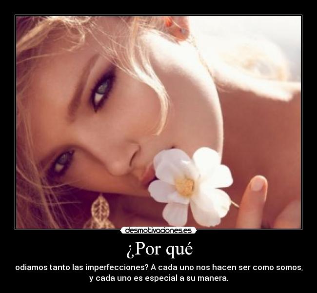¿Por qué - odiamos tanto las imperfecciones? A cada uno nos hacen ser como somos,
y cada uno es especial a su manera.