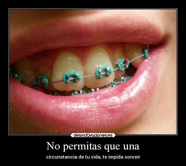 No permitas que una -