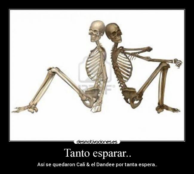 Tanto esparar.. - Así se quedaron Cali & el Dandee por tanta espera..