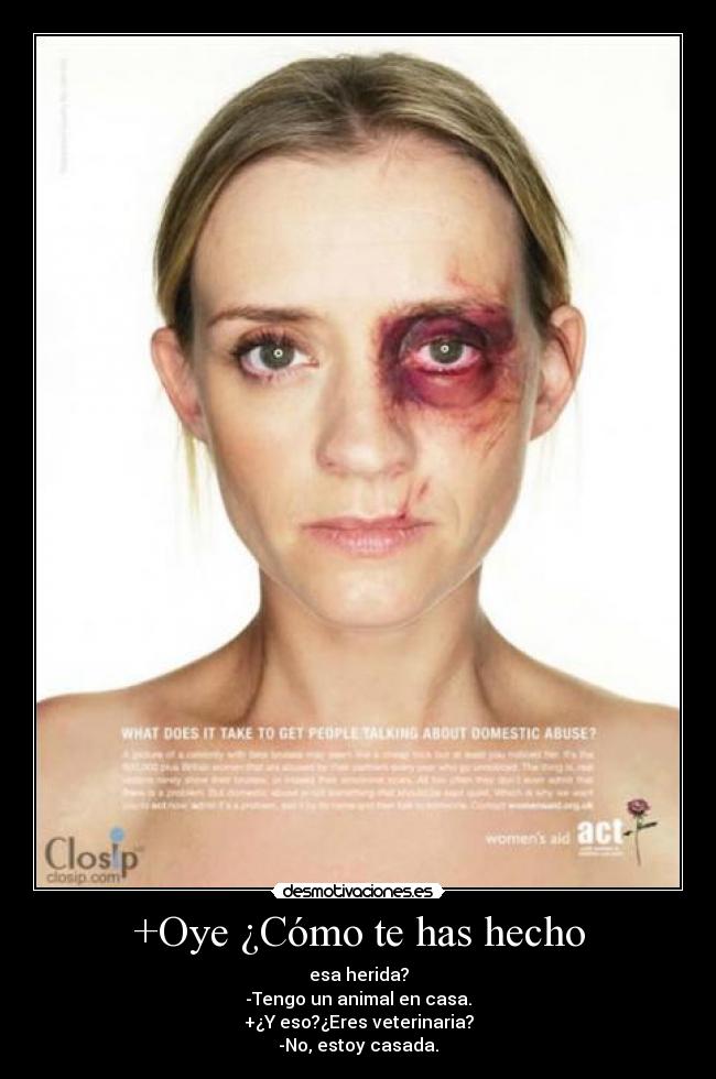 +Oye ¿Cómo te has hecho - 