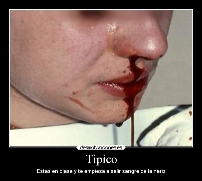 Tipico - Estas en clase y te empieza a salir sangre de la nariz