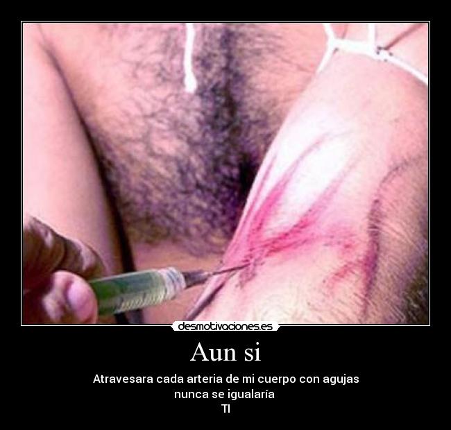Aun si - Atravesara cada arteria de mi cuerpo con agujas
nunca se igualaría
TI