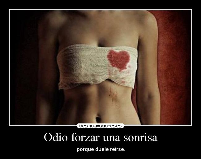 Odio forzar una sonrisa - porque duele reirse.