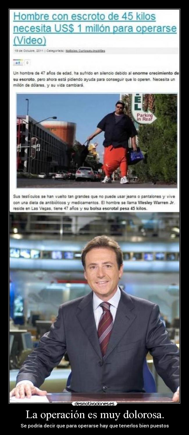 La operación es muy dolorosa. - Se podría decir que para operarse hay que tenerlos bien puestos