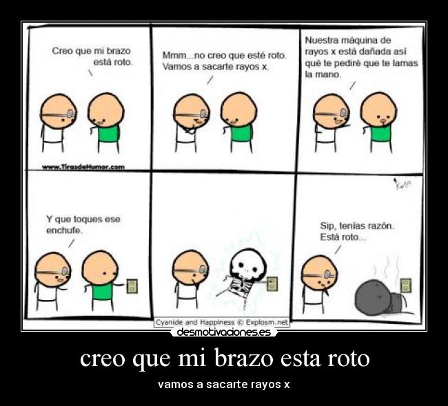 creo que mi brazo esta roto -