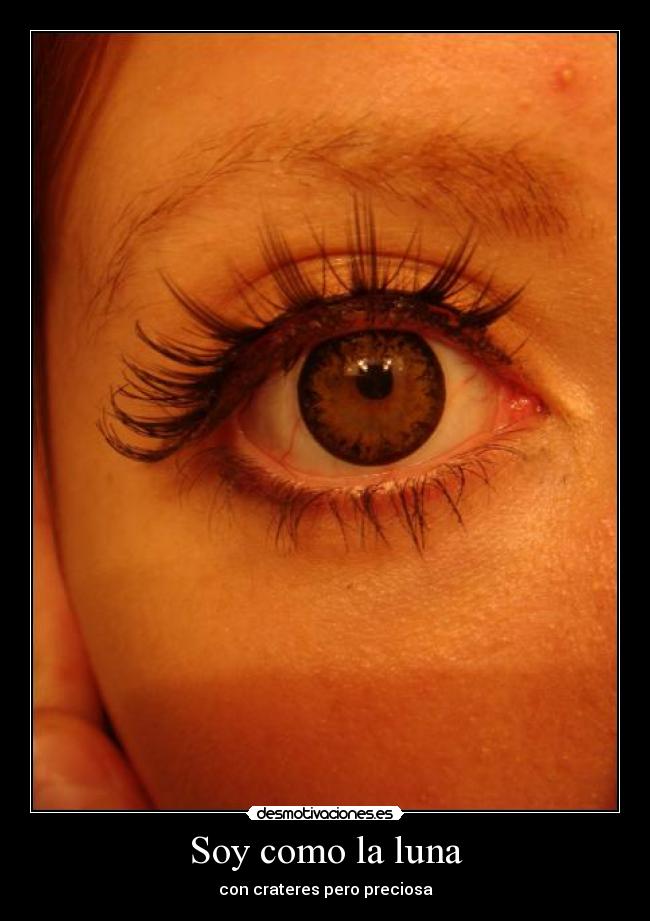 Soy como la luna - con crateres pero preciosa