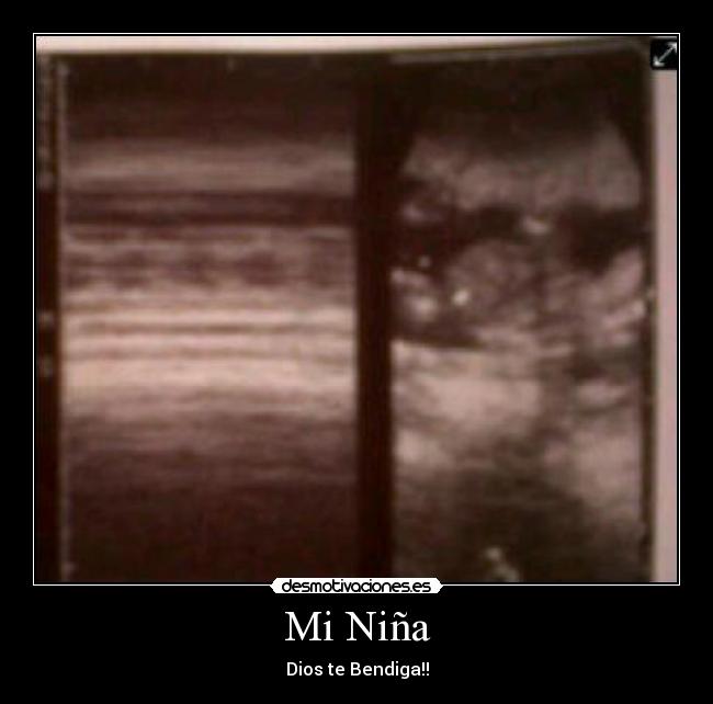 Mi Niña - Dios te Bendiga!!