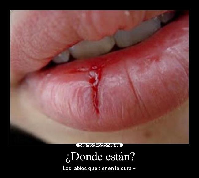¿Donde están? - Los labios que tienen la cura ~♥