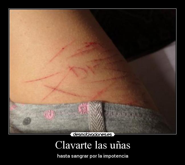 Clavarte las uñas - 