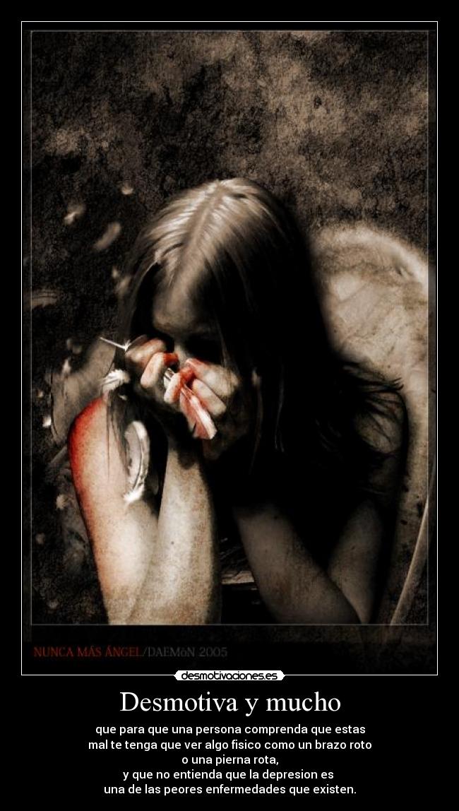 Desmotiva y mucho - que para que una persona comprenda que estas
mal te tenga que ver algo fisico como un brazo roto
o una pierna rota,
y que no entienda que la depresion es
una de las peores enfermedades que existen.