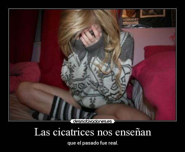 Las cicatrices nos enseñan - que el pasado fue real.