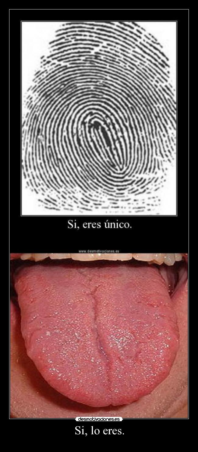Si, lo eres. -