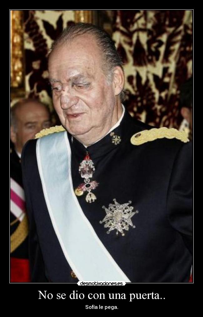 No se dio con una puerta.. -