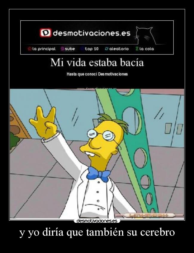 y yo diría que también su cerebro - 