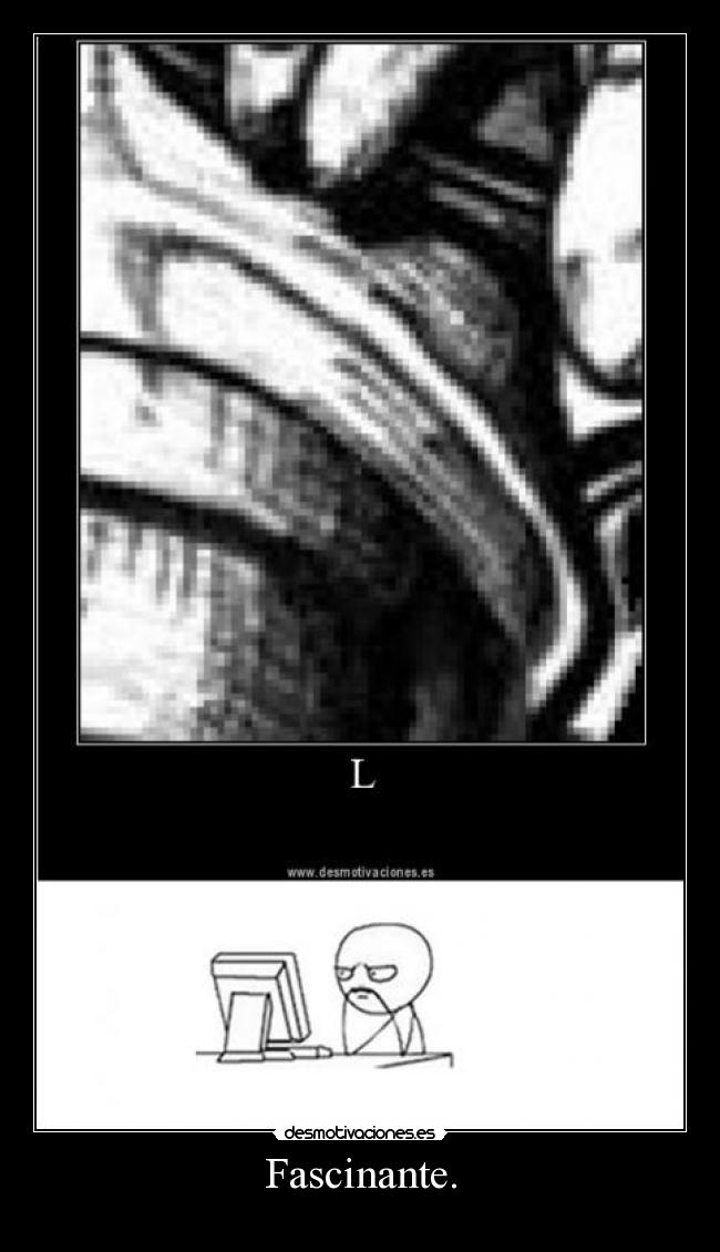 Fascinante. - 