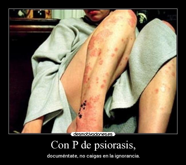 Con P de psiorasis, -