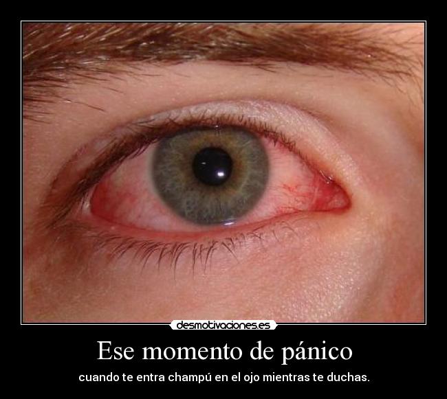 Ese momento de pánico - cuando te entra champú en el ojo mientras te duchas.