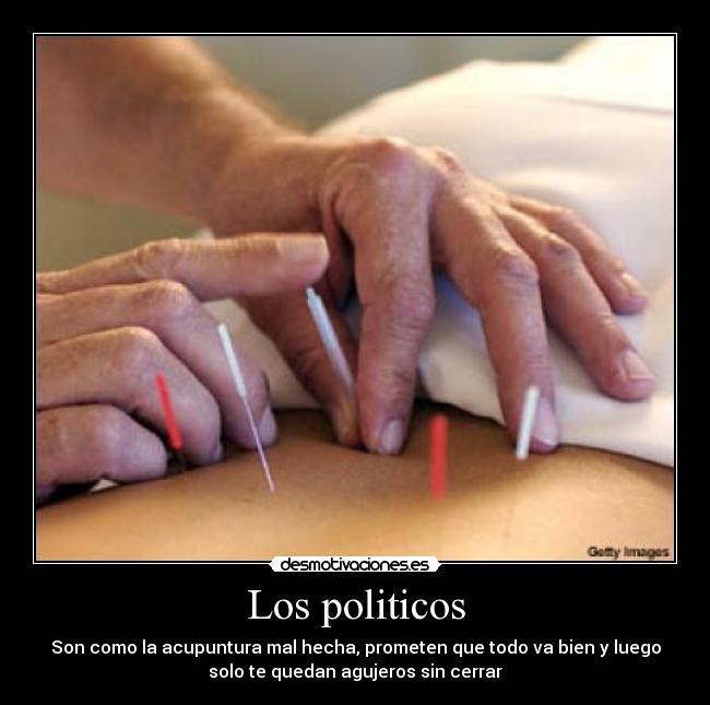 Los politicos - Son como la acupuntura mal hecha, prometen que todo va bien y luego
solo te quedan agujeros sin cerrar