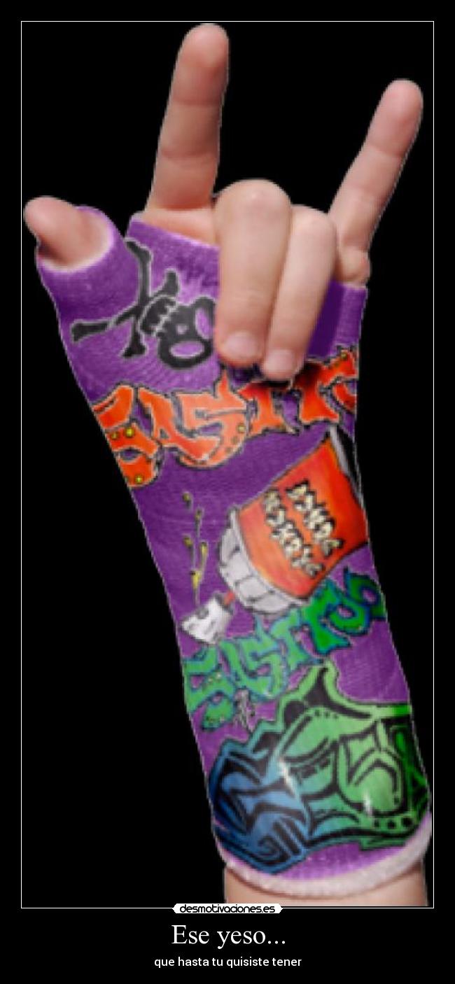 Ese yeso... - que hasta tu quisiste tener