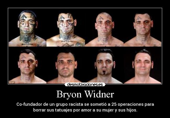 Bryon Widner - Co-fundador de un grupo racista se sometió a 25 operaciones para
borrar sus tatuajes por amor a su mujer y sus hijos.