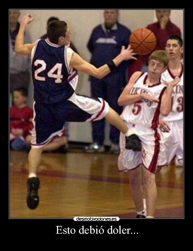 Esto debió doler... -