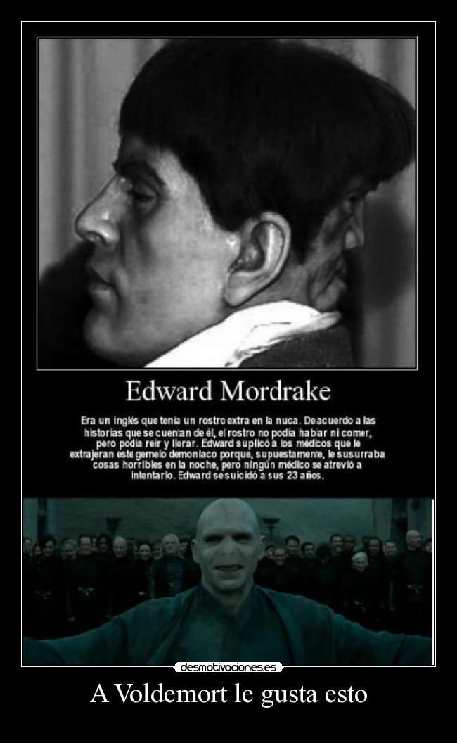 A Voldemort le gusta esto - 