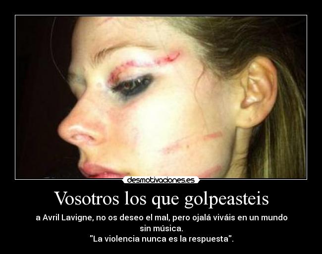 Vosotros los que golpeasteis - a Avril Lavigne, no os deseo el mal, pero ojalá viváis en un mundo sin música.
La violencia nunca es la respuesta.