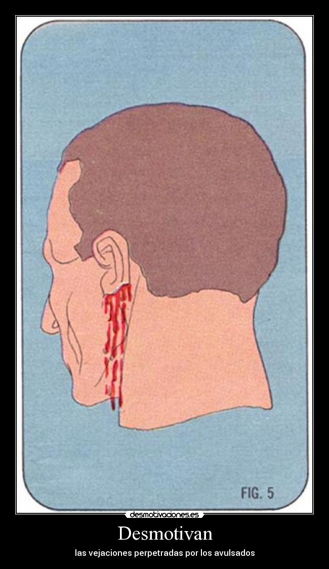 Desmotivan - las vejaciones perpetradas por los avulsados