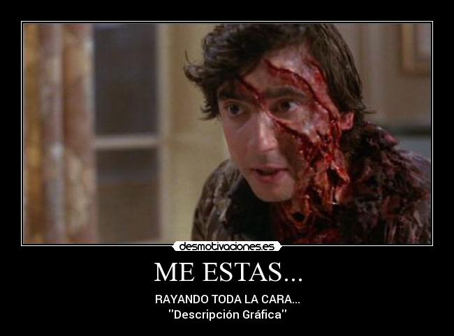 ME ESTAS... - RAYANDO TODA LA CARA...
Descripción Gráfica