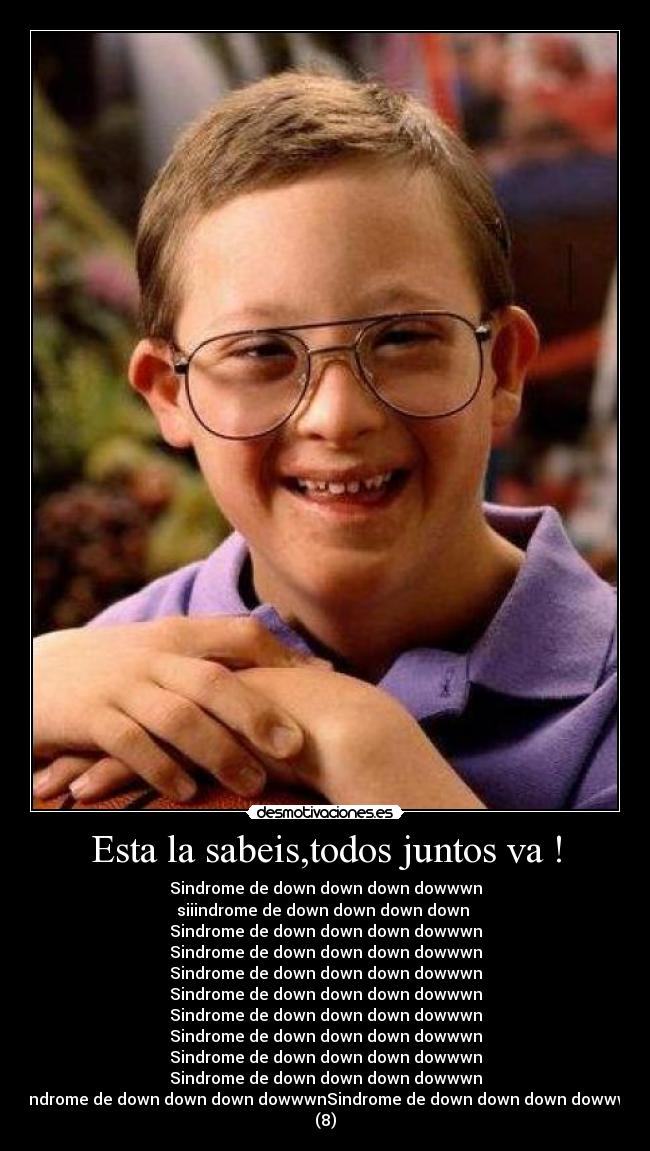 Esta la sabeis,todos juntos va ! - Sindrome de down down down dowwwn
siiindrome de down down down down 
Sindrome de down down down dowwwn
Sindrome de down down down dowwwn
Sindrome de down down down dowwwn
Sindrome de down down down dowwwn
Sindrome de down down down dowwwn
Sindrome de down down down dowwwn
Sindrome de down down down dowwwn
Sindrome de down down down dowwwn
Sindrome de down down down dowwwnSindrome de down down down dowwwn
(8)