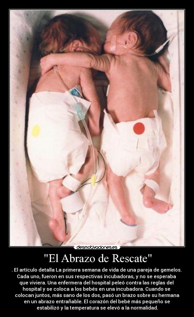 El Abrazo de Rescate - . El artículo detalla La primera semana de vida de una pareja de gemelos.
Cada uno, fueron en sus respectivas incubadoras, y no se esperaba
que viviera. Una enfermera del hospital peleó contra las reglas del
hospital y se coloca a los bebés en una incubadora. Cuando se
colocan juntos, más sano de los dos, pasó un brazo sobre su hermana
en un abrazo entrañable. El corazón del bebé más pequeño se
estabilizó y la temperatura se elevó a la normalidad.