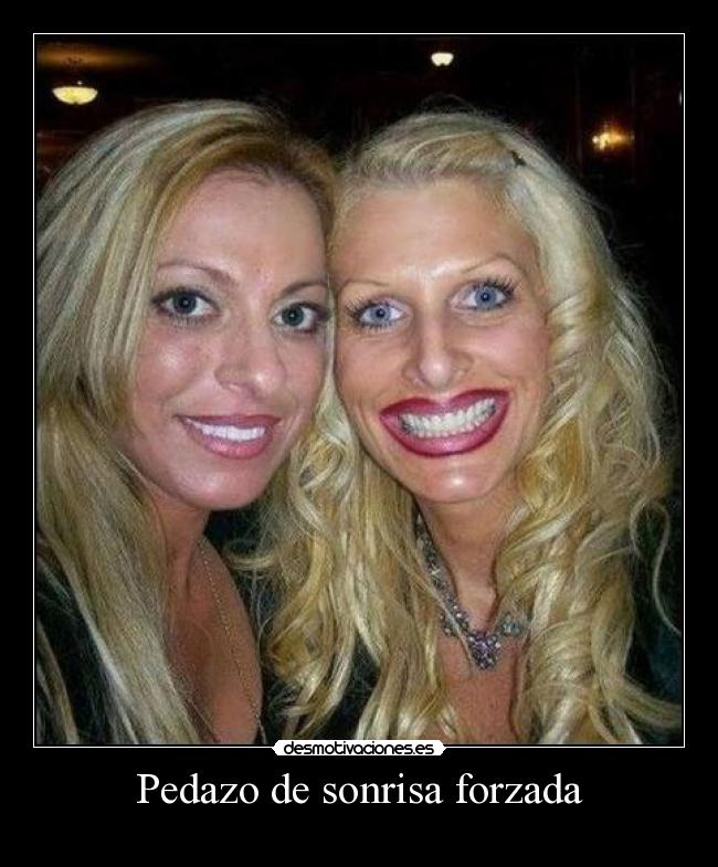 Pedazo de sonrisa forzada -