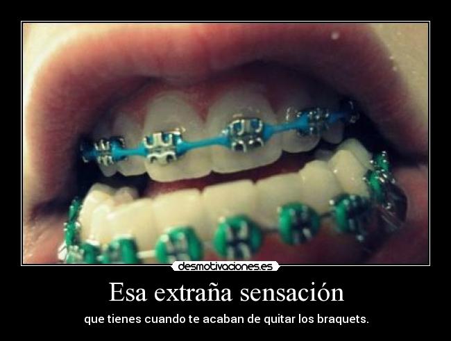 Esa extraña sensación - que tienes cuando te acaban de quitar los braquets.