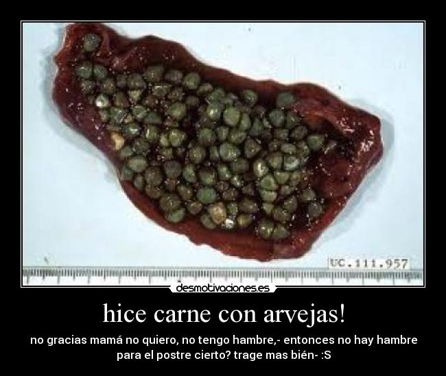 hice carne con arvejas! - no gracias mamá no quiero, no tengo hambre,- entonces no hay hambre
para el postre cierto? trage mas bién- :S