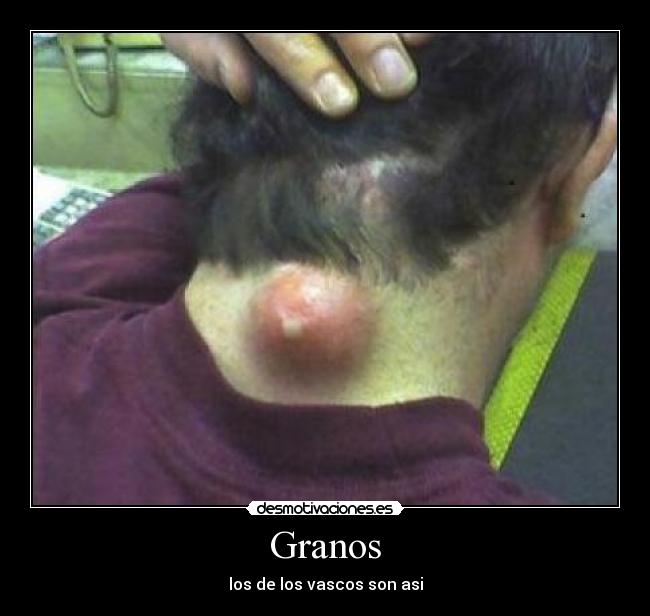 Granos -