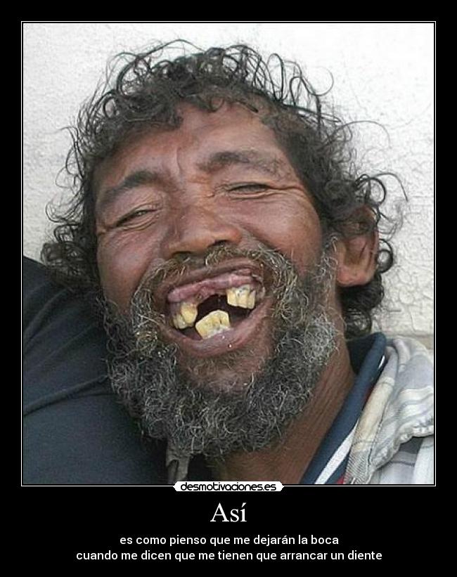 Así - es como pienso que me dejarán la boca
cuando me dicen que me tienen que arrancar un diente