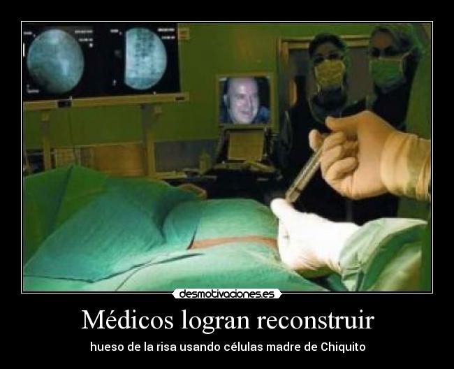 Médicos logran reconstruir - hueso de la risa usando células madre de Chiquito