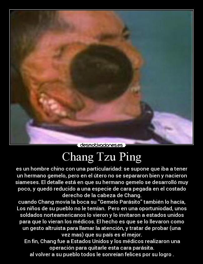 Chang Tzu Ping - es un hombre chino con una particularidad: se supone que iba a tener
un hermano gemelo, pero en el útero no se separaron bien y nacieron
siameses. El detalle está en que su hermano gemelo se desarrolló muy
poco, y quedó reducido a una especie de cara pegada en el costado
derecho de la cabeza de Chang.
cuando Chang movía la boca su Gemelo Parásito también lo hacía,
Los niños de su pueblo no le temían.  Pero en una oportuniodad, unos
soldados norteamericanos lo vieron y lo invitaron a estados unidos
para que lo vieran los médicos. El hecho es que se lo llevaron como
un gesto altruista para llamar la atención, y tratar de probar (una
vez mas) que su país es el mejor.
 En fin, Chang fue a Estados Unidos y los médicos realizaron una
operación para quitarle esta cara parásita.
al volver a su pueblo todos le sonreían felices por su logro .