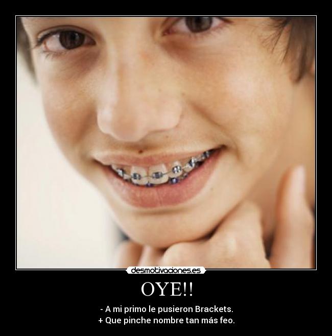 OYE!! - - A mi primo le pusieron Brackets.
+ Que pinche nombre tan más feo.