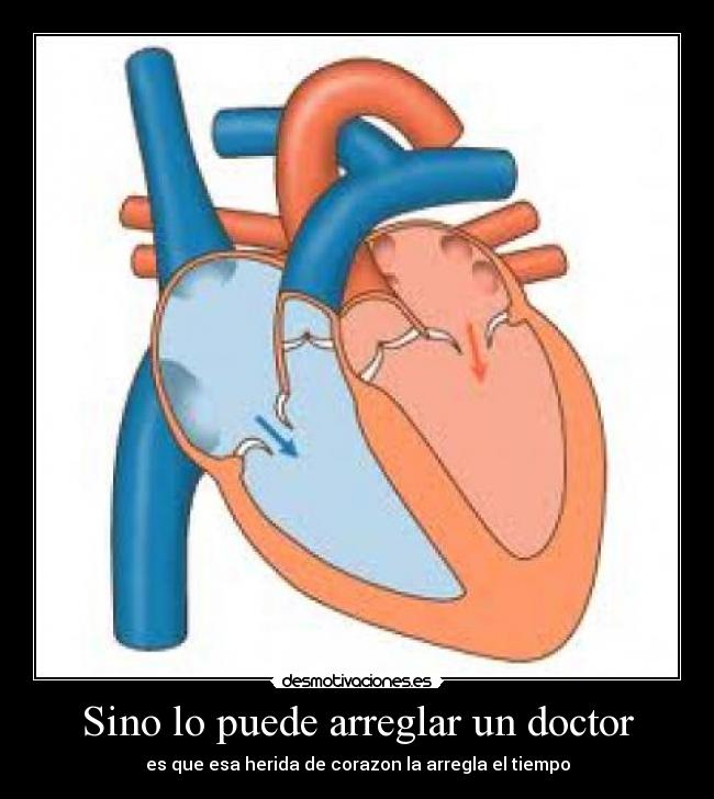 Sino lo puede arreglar un doctor - es que esa herida de corazon la arregla el tiempo