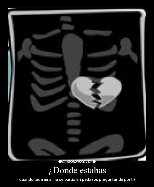 ¿Donde estabas - cuando toda mi alma se partía en pedazos preguntando por ti?