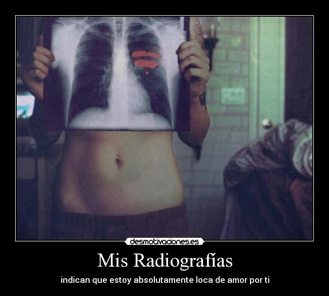 Mis Radiografías -
